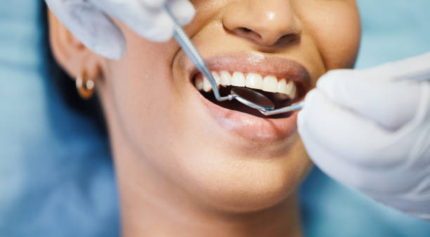 Best Emergency Root Canal Treatment in Alvin, TX