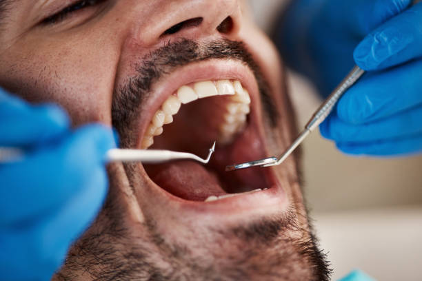 Best Emergency Dental Care for Broken or Chipped Teeth in Alvin, TX